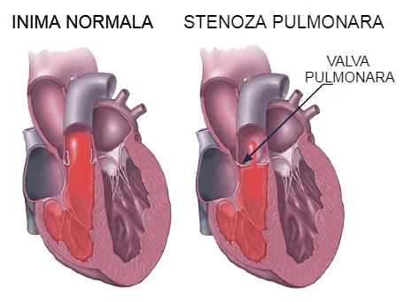 reprezentare stenoza pulmonara caine