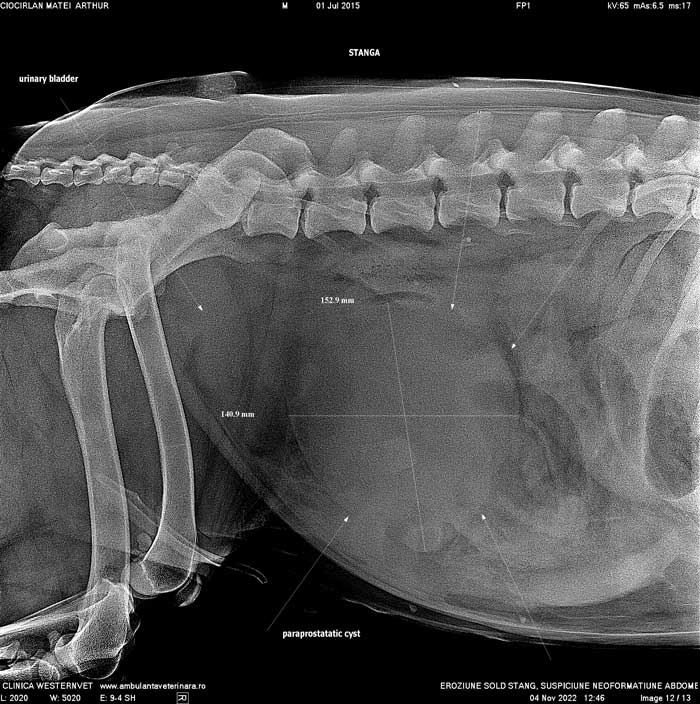 radiografie-chist-paraprostatic
